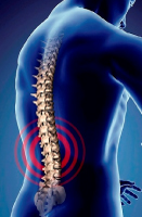 Letchworth Physiotherapy Back Pain image