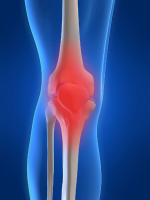 Letchworth Physiotherapy Leg Pain image